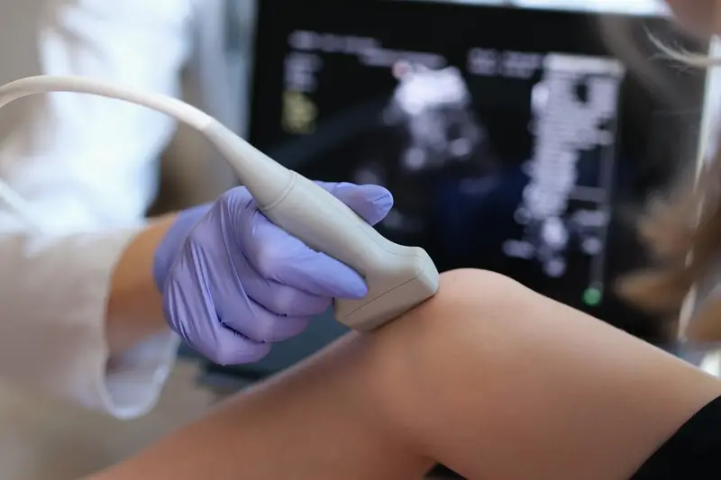 Sonografie des Bewegungsapparates